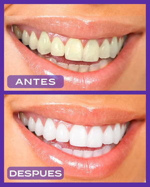 Crema Dental Morada Blankeadora